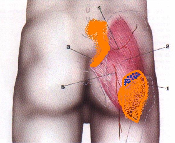 gluteus-fig2.jpg