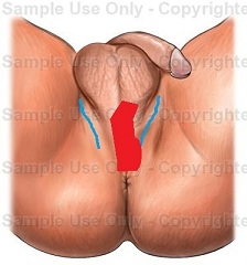 pain area illustration_small.jpg