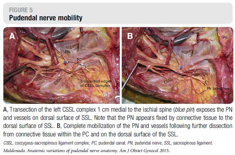 pudendal-nerve-attached.jpg